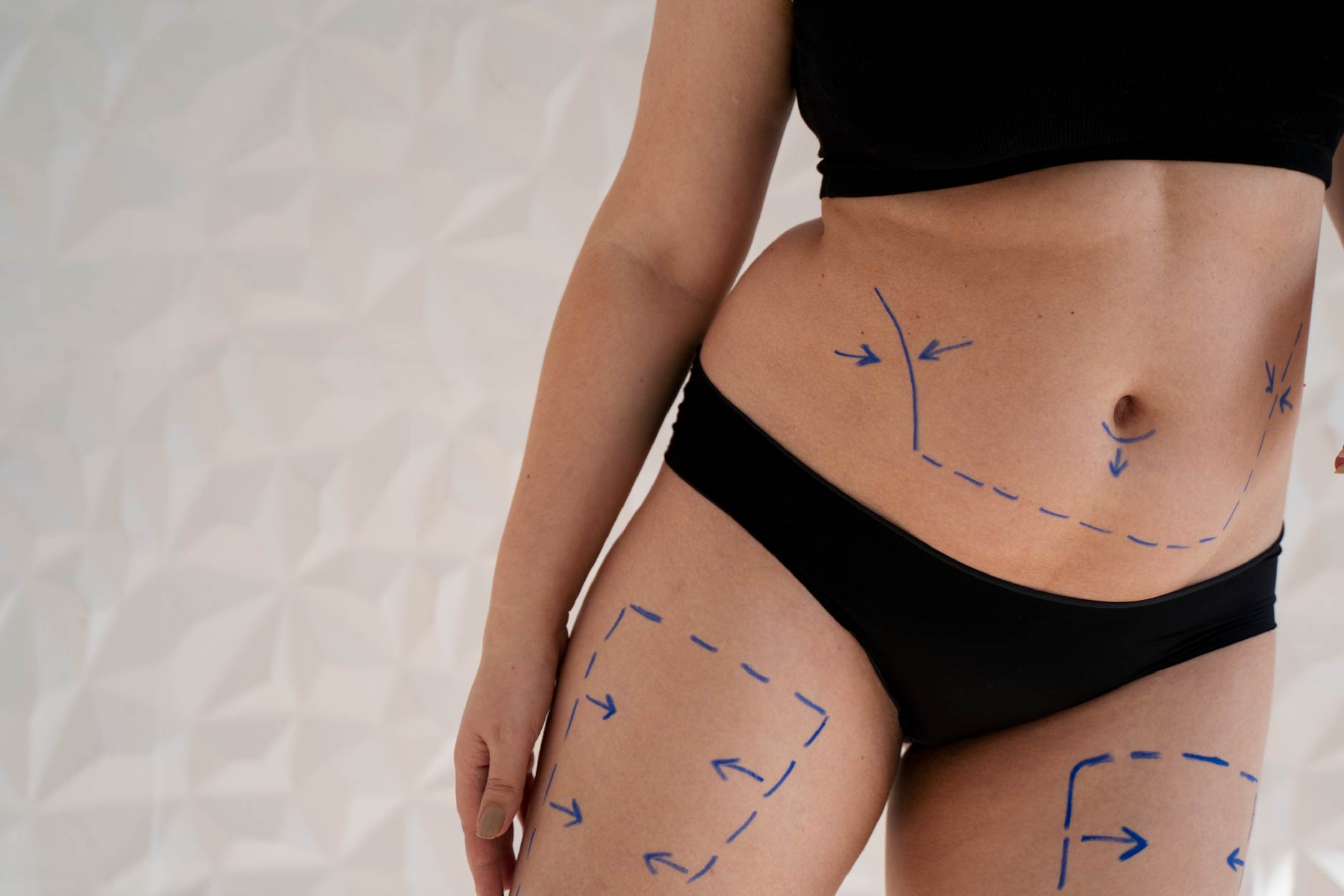 Baneos en Facebook Ads: Palabras y fotos que Meta odia en el sector Estética